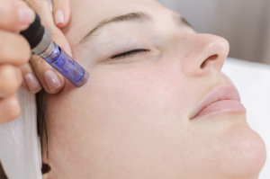 Micro-needling aesthetic treatment